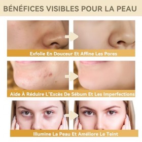 Toner Exfoliant à l’Acide Glycolique 7% – Tonique Quotidien Lissant et Hydratant pour une Peau d’Apparence Saine | Convient a
