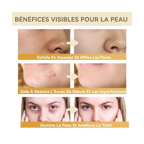 Toner Exfoliant à l’Acide Glycolique 7% – Tonique Quotidien Lissant et Hydratant pour une Peau d’Apparence Saine | Convient a