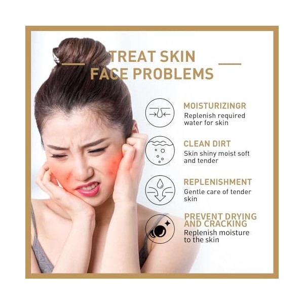 Hydratant Pour Le Visage Au Riz,Toner À Leau Riz,Naturel Extrait De Riz Hydratant Et Hydratant,Tonique pour le Visage au Riz