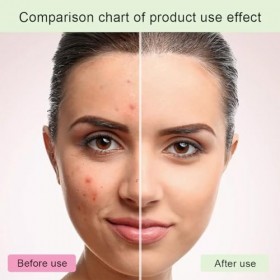 Glycolic Acid 7% Toning Solution,Acide Glycolique 7% Tonique,Moisturising Face Toner,Glycolic Acid Serum Essence,Glycolic Aci