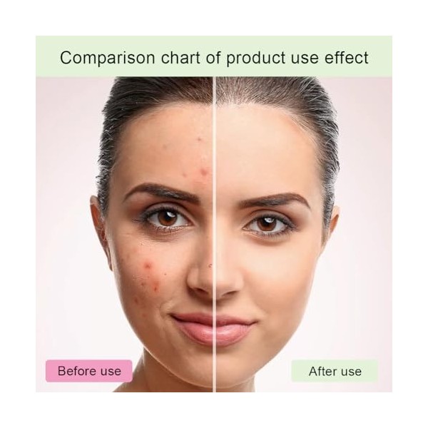 Glycolic Acid 7% Toning Solution,Acide Glycolique 7% Tonique,Moisturising Face Toner,Glycolic Acid Serum Essence,Glycolic Aci