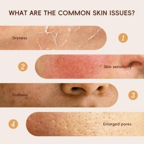 Rice Toner Visage,100ml Glow Riz Toner Au Riz Pour Le Visage Coréen,tonique visages Hydratant À Lextrait De Riz,Pour Peaux S ...