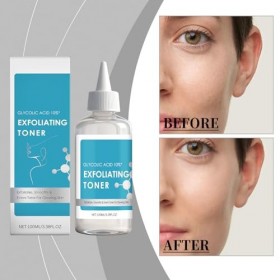 Glycolic Acid Exfoliating Toner, tonique exfoliant doux pour le visage à lacide glycolique, solution tonifiante pour un usag