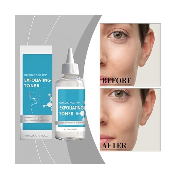 Glycolic Acid Exfoliating Toner, tonique exfoliant doux pour le visage à lacide glycolique, solution tonifiante pour un usag