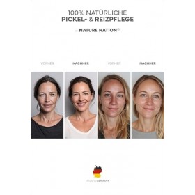 Spray tonique bio au zinc pour le visage : nettoyage du visage contre les imperfections et affiner le grain de la peau . 4 % 