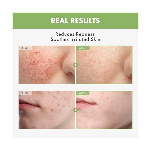 TOSOWOONG Tonique pour le visage Heartleaf Water Centella, acide hyaluronique, 250 ml, 8,45 fl.oz.