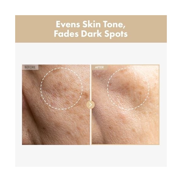 TOSOWOONG Eau de riz coréenne Rice Glow Milky Toner 250 ml 8,45 fl.oz