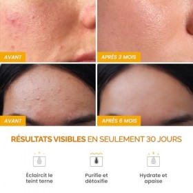PLANTIFIQUE Masque à lArgile de Curcuma Coréen avec Vitamine C – Cible les Taches Sombres, Affine les Pores, Hydrate et Apai