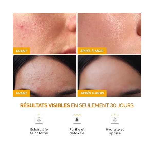 PLANTIFIQUE Masque à lArgile de Curcuma Coréen avec Vitamine C – Cible les Taches Sombres, Affine les Pores, Hydrate et Apai