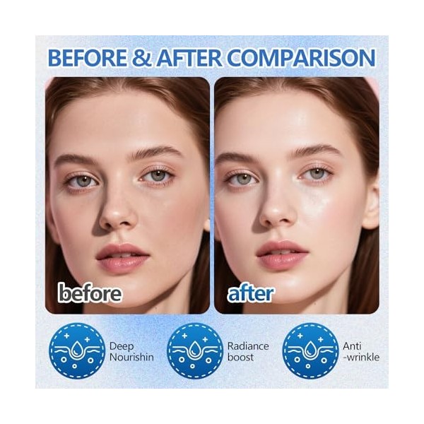 6 PièCes Masque Visage Avec Acide Hyaluronique, Masque Visage Hydratant, Masque Hydratant & Anti-âGe, Raffermit La Peau, Ress