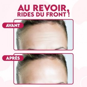 Patch Anti Rides Front Nuit – Patch Anti Rides Visage Lissant avec Acide Hyaluronique, Peptides & Collagène – Soin Hydrogel A
