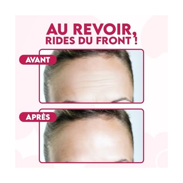 Patch Anti Rides Front Nuit – Patch Anti Rides Visage Lissant avec Acide Hyaluronique, Peptides & Collagène – Soin Hydrogel A