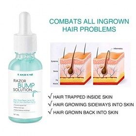 Baume après rasage - Baume post-épilation pour minimiser les poils incarnés, réduire les éruptions cutanées et les rougeurs d