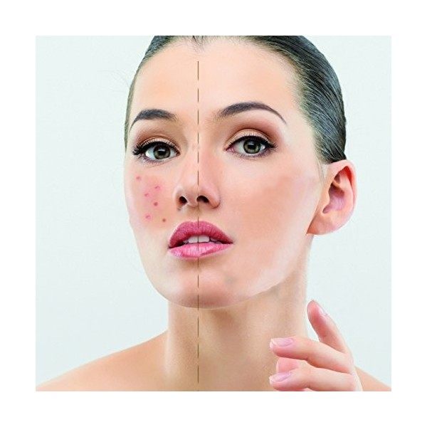 Ikos - Cache-cernes CS 3,5g, Coverstick Anti-cernes / Correcteurs