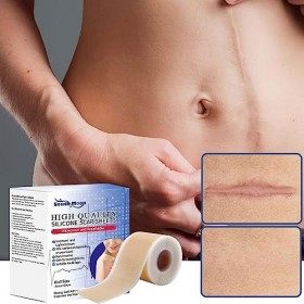 Autocollant de retrait de cicatrice, Ruban en silicone respirant pour enlever les cicatrices, Multifonctionnel peau cicatrice