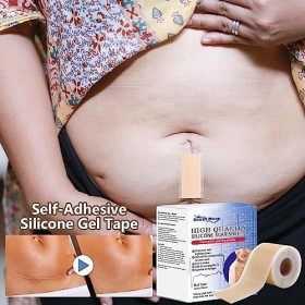 Autocollant de retrait de cicatrice,Ruban en silicone respirant pour enlever les cicatrices | Multifonctionnel peau cicatrice