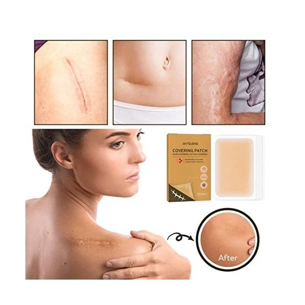 Autocollants de Couverture de Cicatrice, Autocollant de Couverture de Tatouage Respirant Doux et Imperméable sans Danger pour