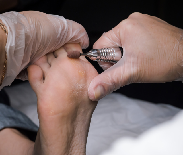 Exfoliation du pied avec une pierre ponce