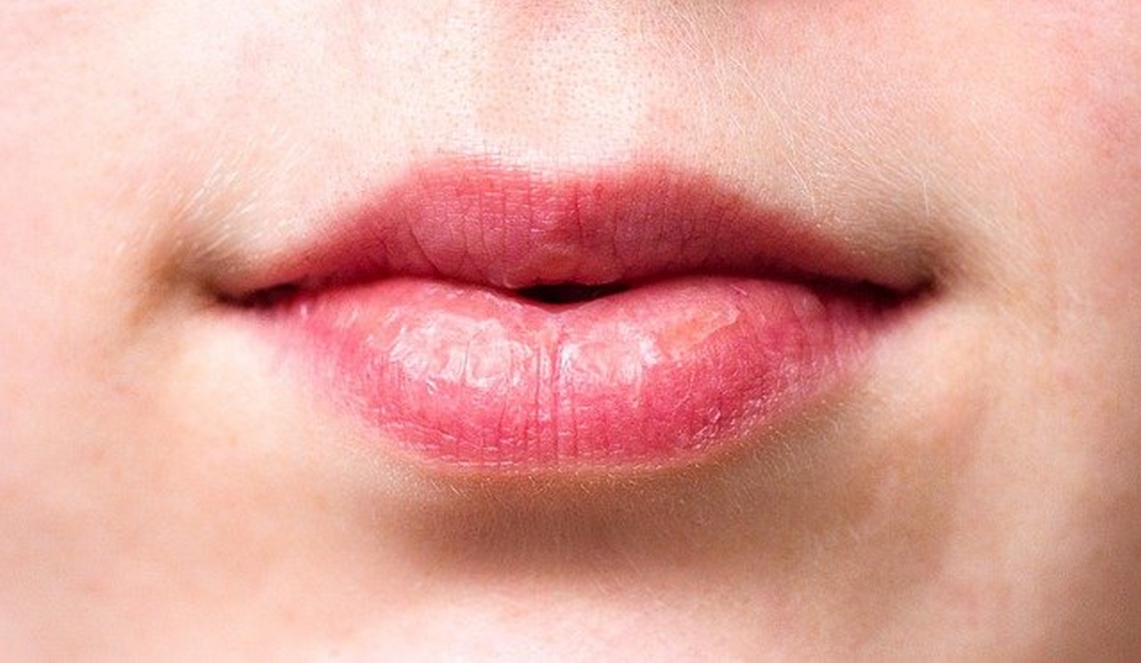 Evitar la sequedad de los labios